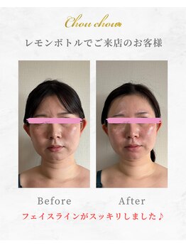 シュシュ(Chouchou)/レッドショット1回