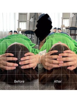 カノン(Kanon)/頭蓋骨矯正