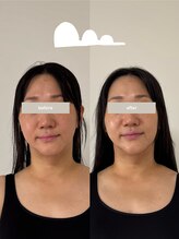 こつこつラボ サンイチマル オオル(310/OOL')/［40代/歪み/左右差/たるみ］