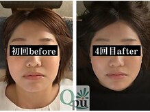 キュープ 鹿児島伊集院店(Qpu)/