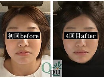 キュープ 鹿児島伊集院店(Qpu)/