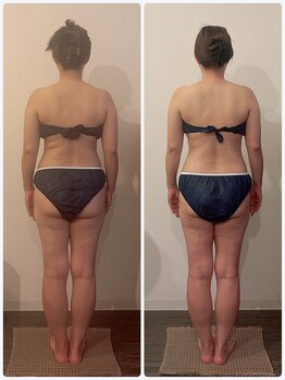 ガーレット(Garlett)/むくみ改善×ボディライン整え