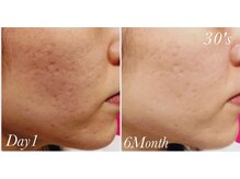 フィーリング 宝塚店(Feeling)の雰囲気（REVIで毛穴ふっくら◎）