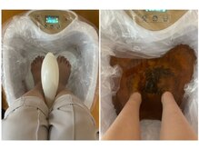 サロンピュア 所沢店/デトックス・ビフォーアフター♪