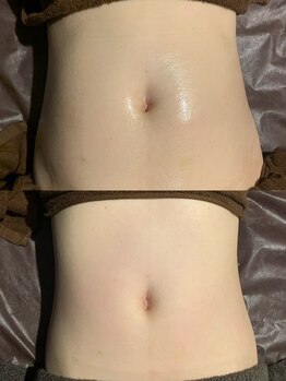 EMI 上野店/#サイズダウンを目指したい