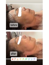 ビンナ 五反田店(Binna)/小顔矯正