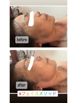 ビンナ 五反田店(Binna)/小顔矯正