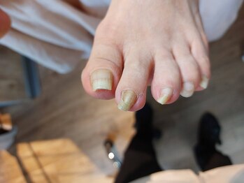 爪切り屋 足楽/長いひとさしゆび