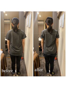 eMe和筋膜リリース/before.after(30代女性)