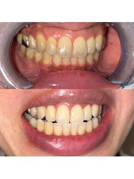 ライトビューティー 池袋店(LightBeauty)/症例写真