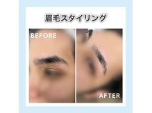 ノンプレックス(NON PLEX)の雰囲気（なりたい理想を確認しお顏のバランスを考慮した上で施術します◎）