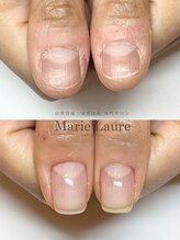 マリーロール 梅田店(Marie Laure)/深爪改善/自爪育成/ネイルケア
