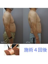 アップルミント/＜痩身＞before・after