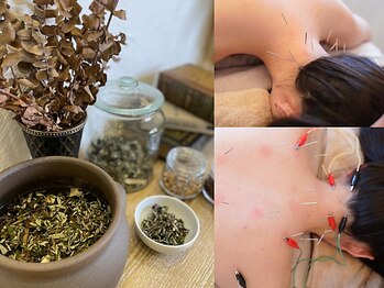 ストリ(STRI)の写真/お友達とのご利用や記念日やスパデートに♪思い出に残る癒しの時間をご提供★眼精疲労/肩こり/冷え改善に
