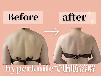 エステサロン ヴリエ 立川店の写真