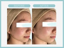 アコガレコガオ 青森店/