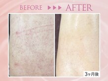 クリアラボ 池袋2nd(Clear Lab)/韓国肌管理&毛穴洗浄専門店