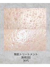 コンクパール(CONCH PEARL.)/陶肌トリートメント
