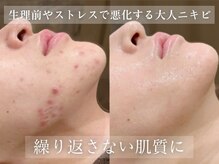 エピア 豊田店(Epia)