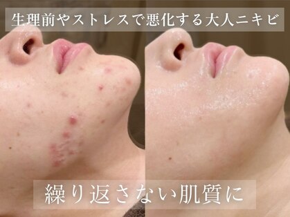 エピア 豊田店(Epia)の写真