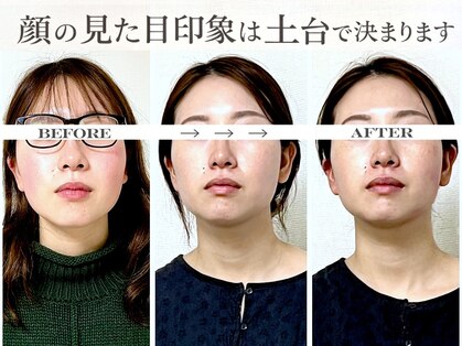 ミラ 長崎駅前店(MIRA)の写真