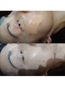 ボーソリューション(Beau-Solution)/【50代　エイジングケア】