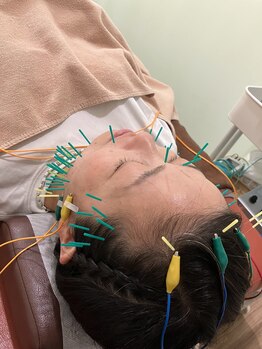 ハリスル 神戸訪問鍼灸付属治療院(harisuru)/睡眠にも効く!