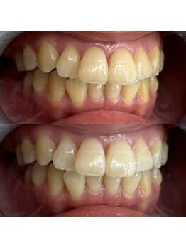 ライトビューティー 池袋店(LightBeauty)/症例写真