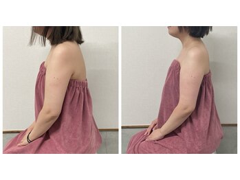 ブリランテ(Brillante)/