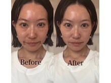 イヴトワエ(eiv Toi et A)/Before &nbsp;After