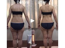 ルチア(LUCIA)/ブライダル/1回から結果出します