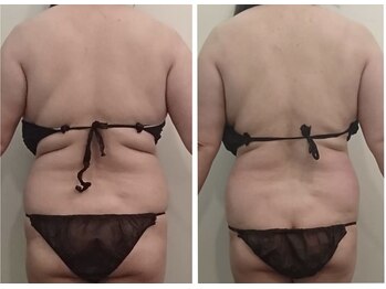 アムプラス(AM+)/痩身//機械&ハンド