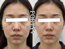 フォーティープラス(FORTY+)/施術事例