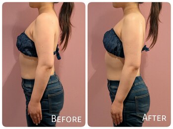 ククナ 上越店(KUKUNA)/30代女性（姿勢矯正１回）