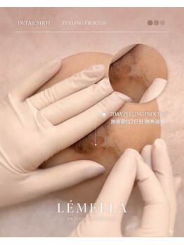 エルビービュティーサロン(LB BEAUTY SALON)/【ルメラ乳輪】実績数関西1★