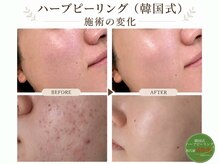 イオム ビューティワーク(IOM BEAUTY WORK)