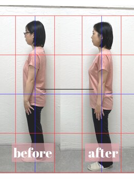 整体アンドボディメイク 禅/【猫背矯正】施術回数1回