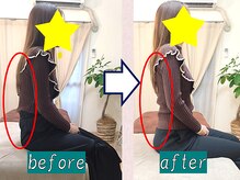 奏流(soryu)/猫背矯正！背中がぐっと伸びる！