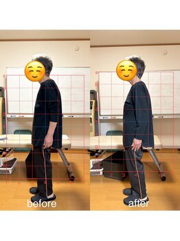 カイロプラクティック ネクサス/猫背と膝の違和感を撃退☆