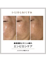 サラシック(salachic)/