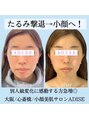 アディス 心斎橋(ADISE)&nbsp;コルギでたるみ改善、中顔面短縮◎顔のコケ、たるみが気になる方