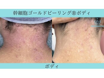 リメイク 広尾(REMAKE)/