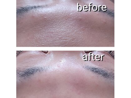 ターン(turn)の写真