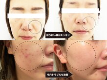 ヴァカンス 梅田阪急17番街店(VACANCES)