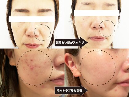 ヴァカンス 梅田阪急17番街店(VACANCES)の写真