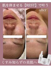 サロン ド モモ(salon de momo)/レストセルトリートメント