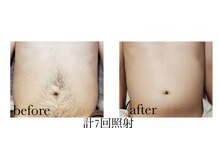 アンド エヌ(&n)/◆脱毛◆