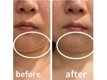 ポーラ 北花田店(POLA)の雰囲気(一人ひとりの悩みに合わせたお手入方法もアドバイスしております)