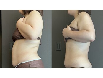 ステラ(Stella)/本気で変わりたい方発見！