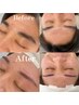 【ワンランク上のケア】眉毛ワックス×おでこワックス